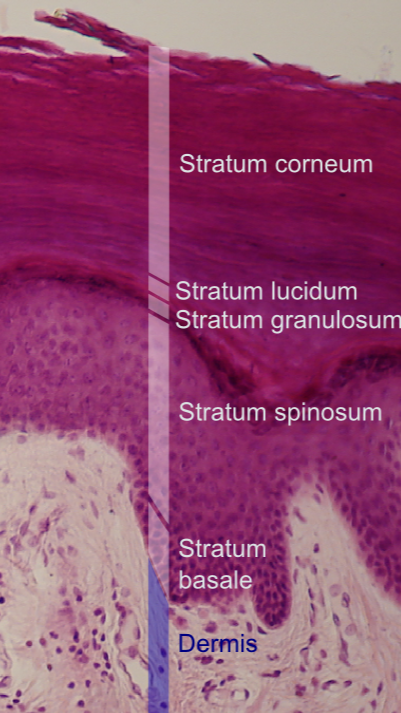 Secțiune histologică a pielii cu straturile epidermei etichetate: stratum corneum, lucidum, granulosum, spinosum, basale și derma.